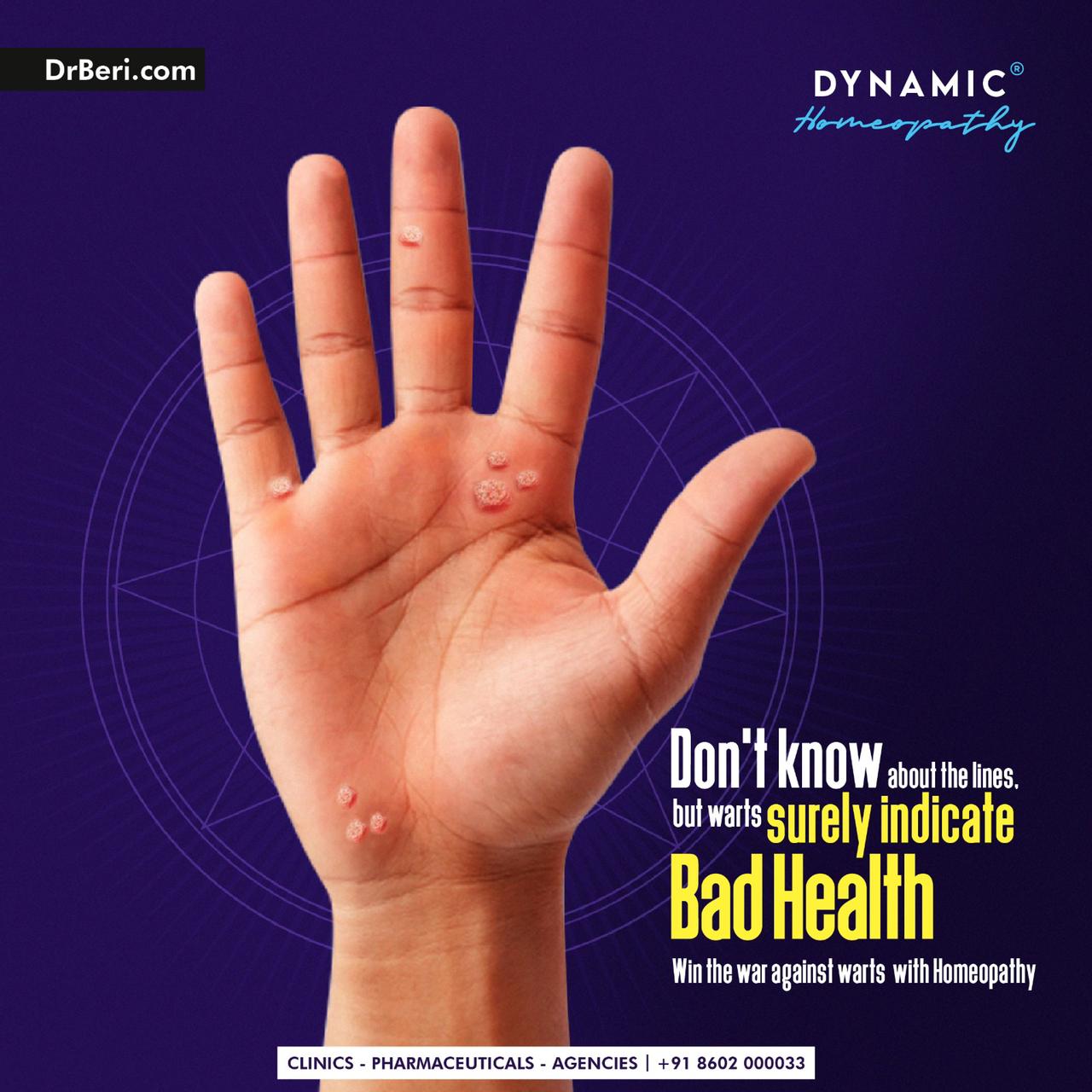 top homeopathic medicines for warts