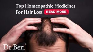 homeopathic treatment for hair fall