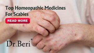 "Medical professional diagnosing skin condition linked to scabies"