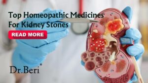 Kidney Stones Treatment