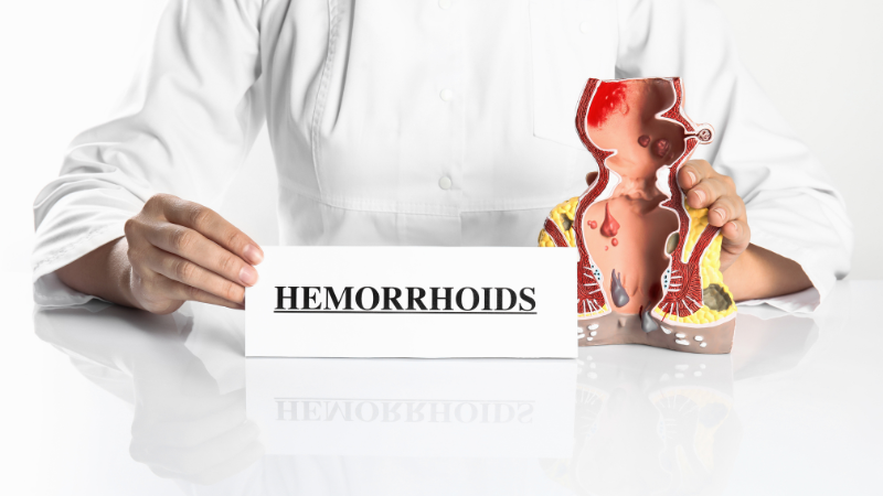 Hemorrhoids Treatment 