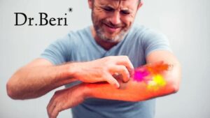 Treatment for Harmful Chemicals in Holi Colors