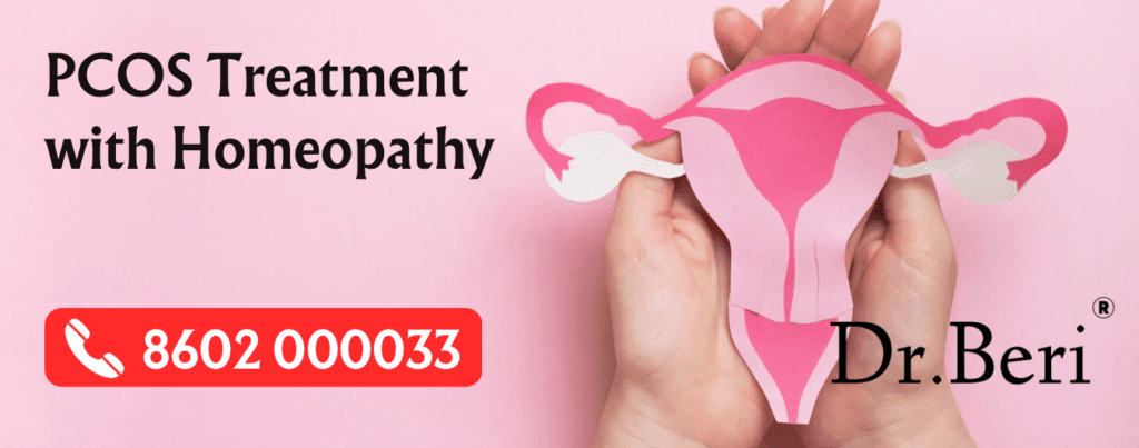 Homeopathy for PCOS