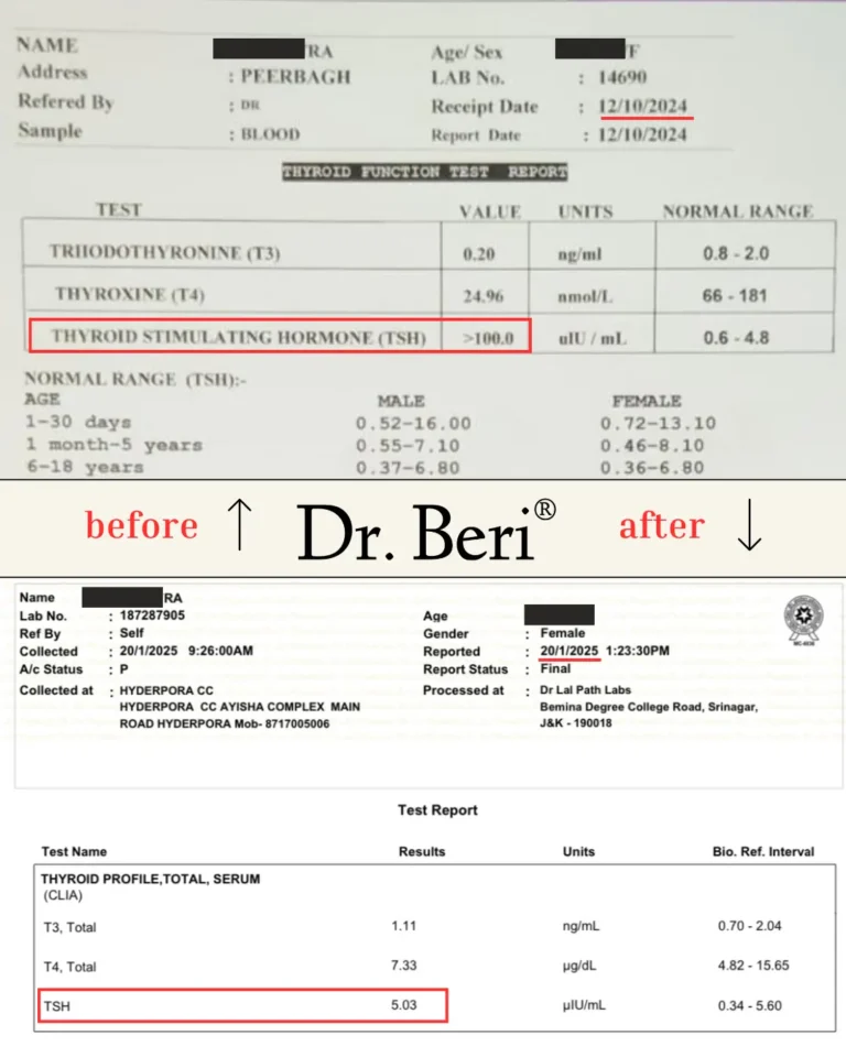 Homeopathy treatment thyroid before and after