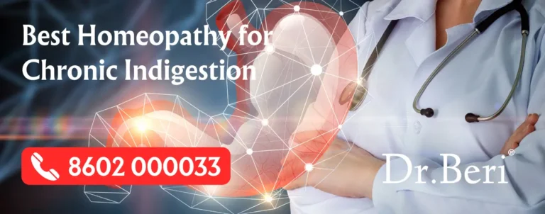 homeopathic remedies-chronic indigestion