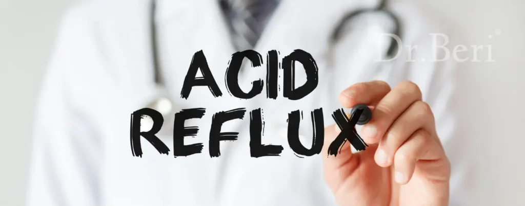 Acid Reflux Symptoms