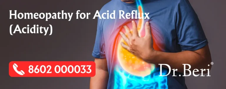 Homeopathy for Acid Reflux and Burning Chest Pain