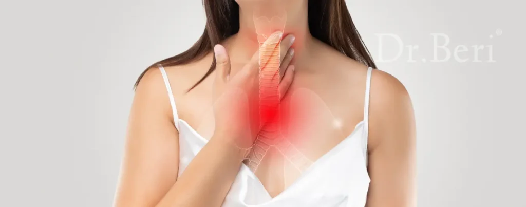 When to Get Medical Help for Acid Reflux