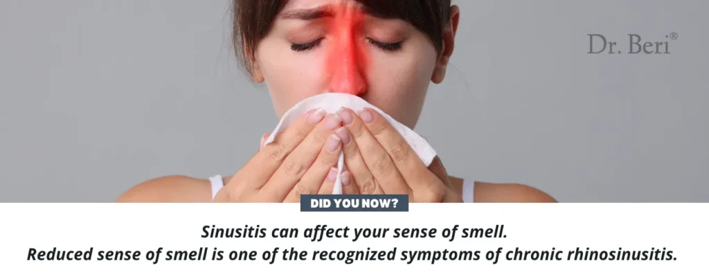 Sinusitis Facts