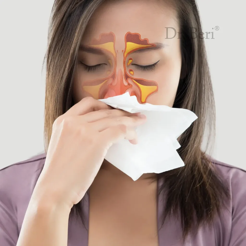 Sinusitis Homeopathy