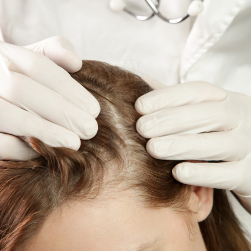 homeopathy treatment for hair loss